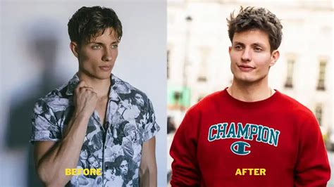 matt rife bulge|Matt Rife before and after: The plastic surgery rumors, explained.